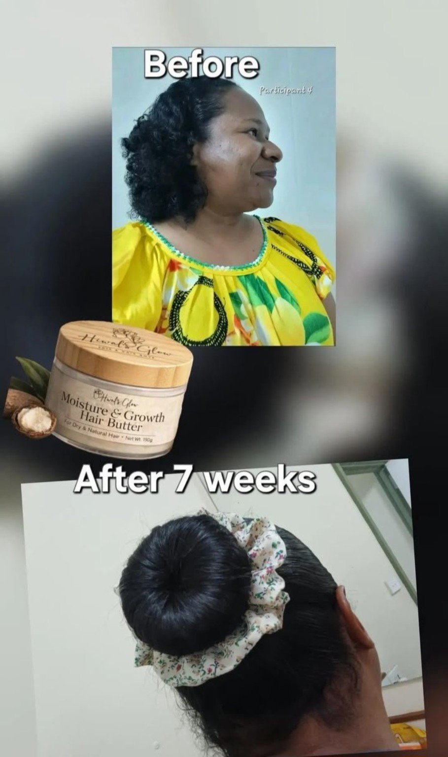 Customer before and after seven weeks hair progress