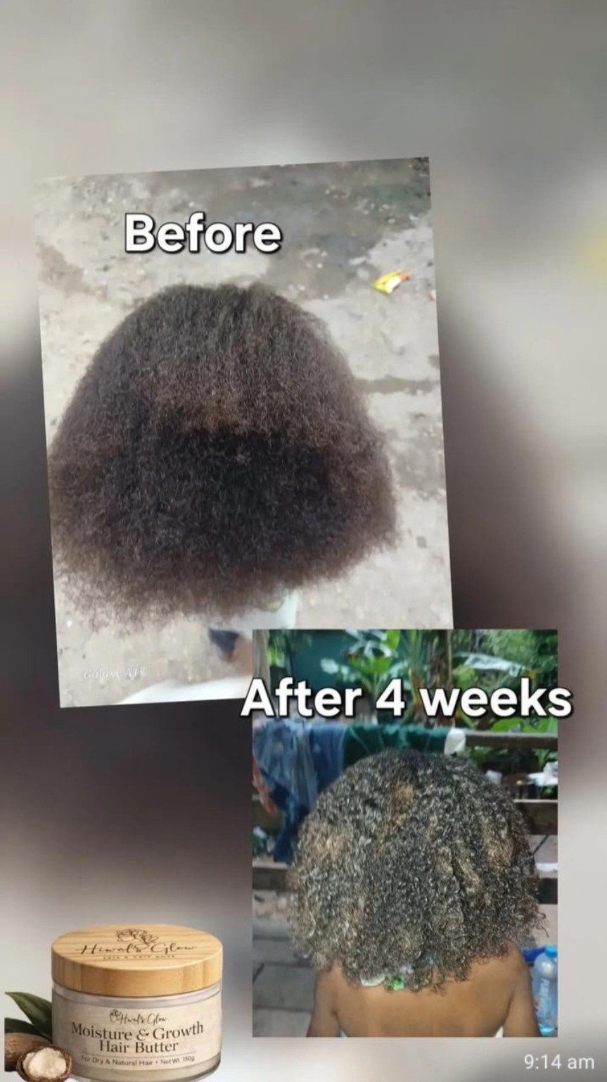 Customer before and after four weeks hair progress from above